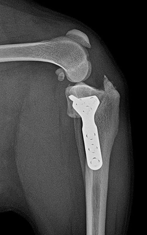 TPLO-M 2.4 with Smartvet polyaxial symmetrical TPLO plate (R15) 2