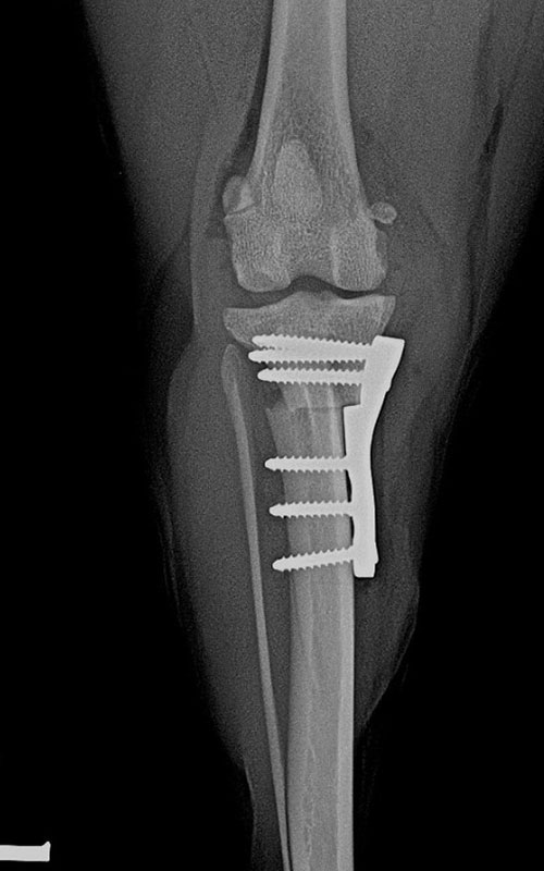 TPLO-M 2.4 with Smartvet polyaxial symmetrical TPLO plate (R15) 3