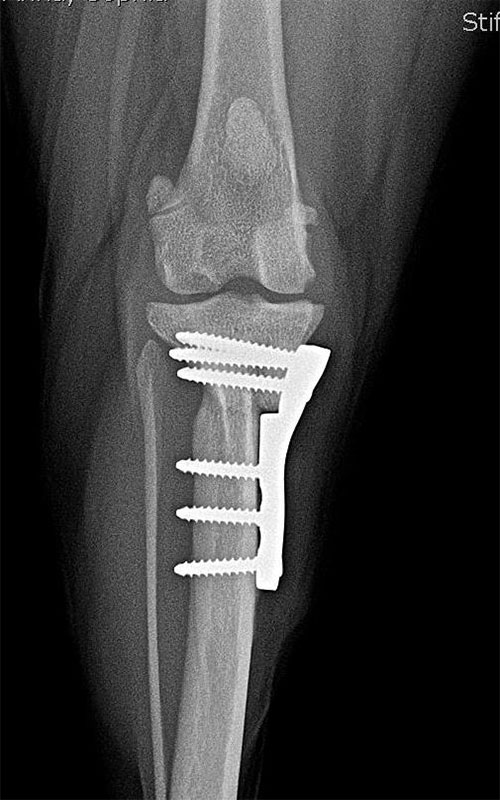 TPLO-M 2.4 with Smartvet polyaxial symmetrical TPLO plate (R15) 4