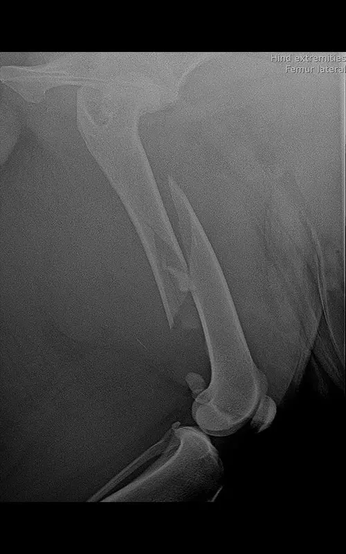 Combination of polyaxial locking plating 6