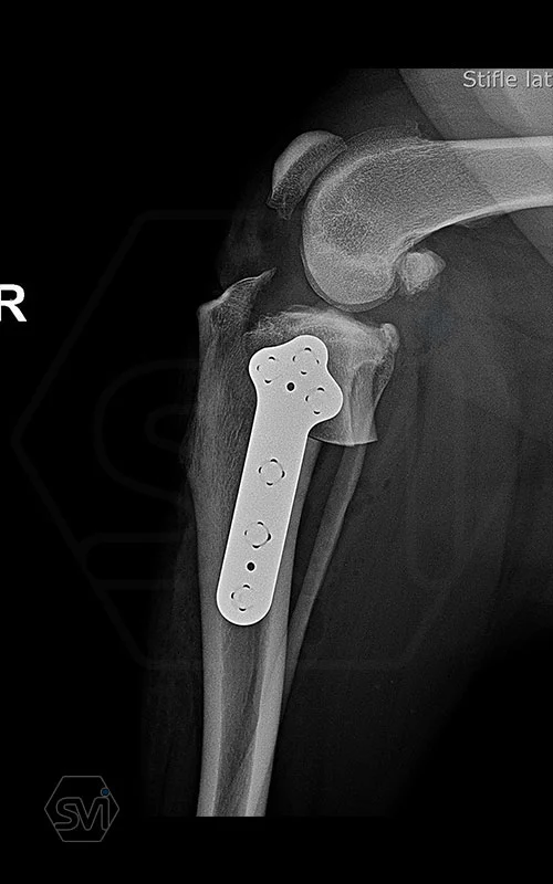 The NEW precontoured polyaxial locking TPLO plate family 3