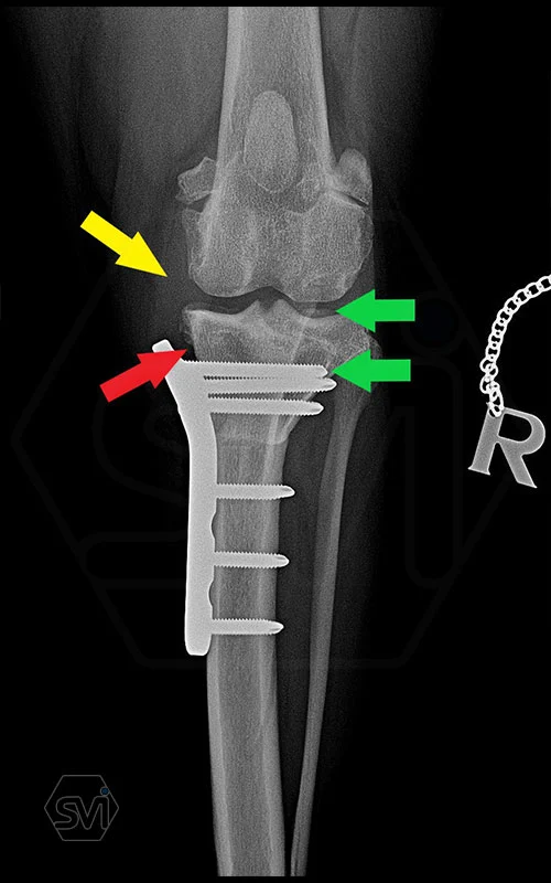 Tips for using precontuered poliaxial locking TPLO plates