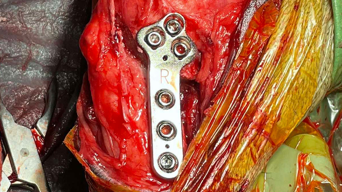 TPLO-M in size 2.7