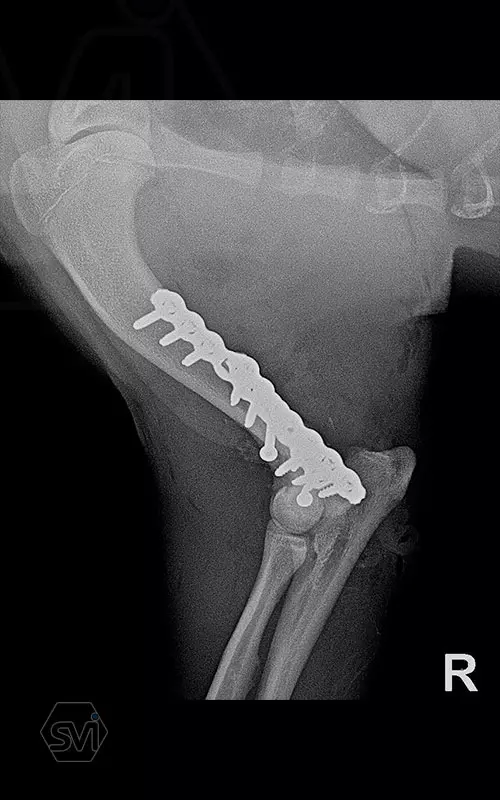 What used to be a nightmare type of surgery 2